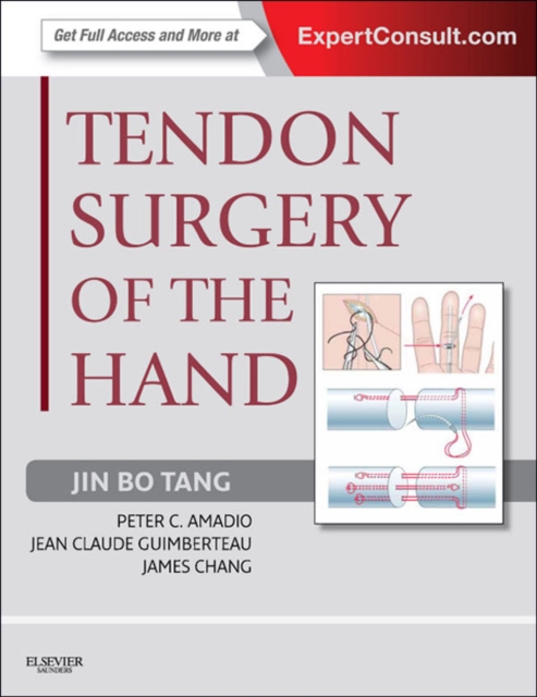 Tendon Surgery of the Hand E-Book : Expert Consult - Online and Print, EPUB eBook