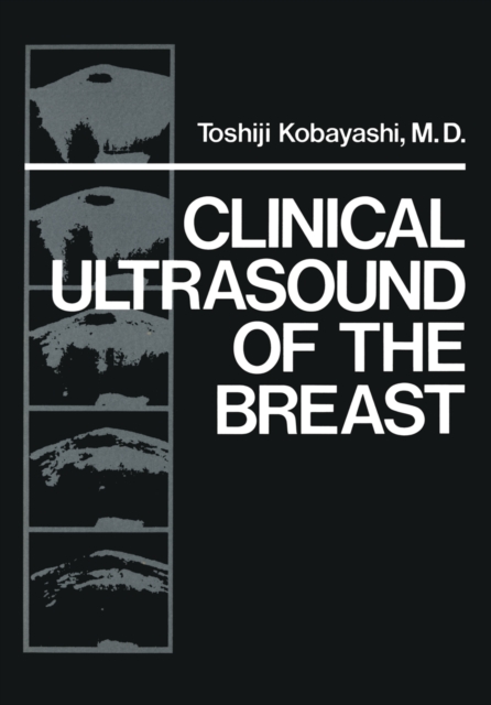 Clinical Ultrasound of the Breast, PDF eBook