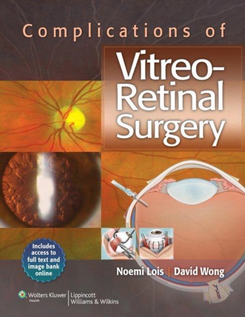 Complications of Vitreo-Retinal Surgery, EPUB eBook
