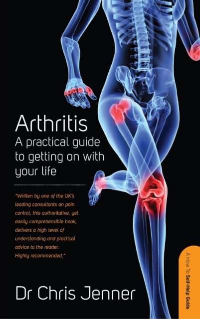 Arthritis : A Practical Guide to Getting on With Your Life, EPUB eBook