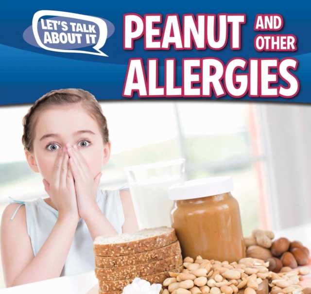 Peanut and Other Food Allergies, PDF eBook