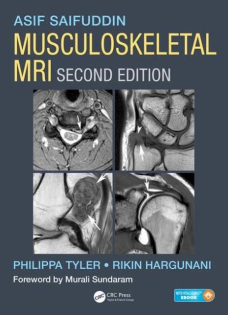 Musculoskeletal MRI, Hardback Book