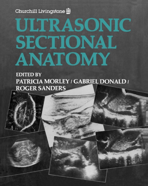 Ultrasonic Sectional Anatomy, EPUB eBook