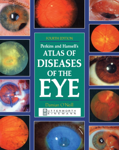 Perkins and Hansell's Atlas of Diseases of the Eye, PDF eBook