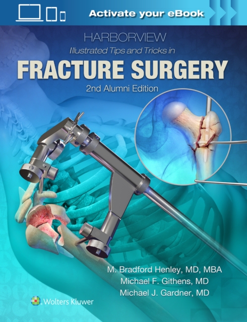 Harborview Illustrated Tips and Tricks in Fracture Surgery, Hardback Book