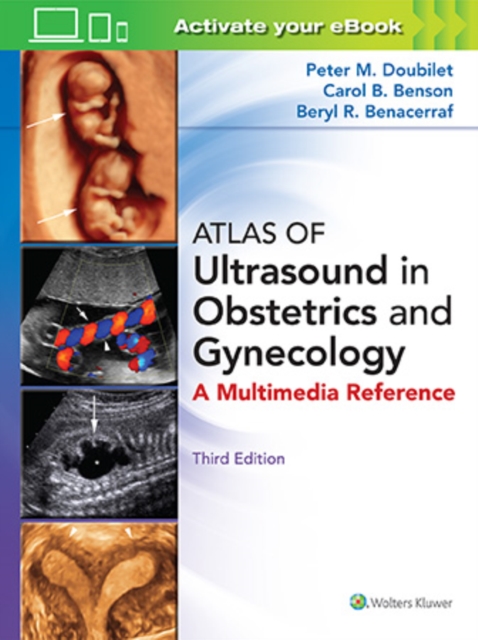 Atlas of Ultrasound in Obstetrics and Gynecology, Hardback Book