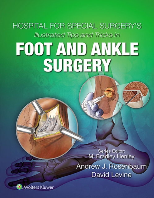 Hospital for Special Surgery's Illustrated Tips and Tricks in Foot and Ankle Surgery, EPUB eBook