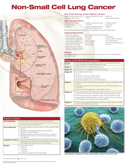 Non-Small Cell Lung Cancer, Wallchart Book