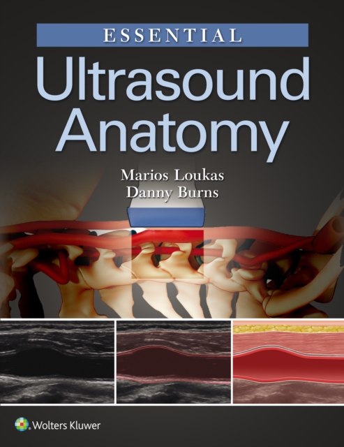 Essential Ultrasound Anatomy, Paperback / softback Book