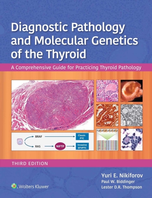 Diagnostic Pathology and Molecular Genetics of the Thyroid : A Comprehensive Guide for Practicing Thyroid Pathology, EPUB eBook