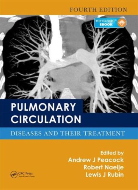 Pulmonary Circulation : Diseases and Their Treatment, Fourth Edition, Hardback Book
