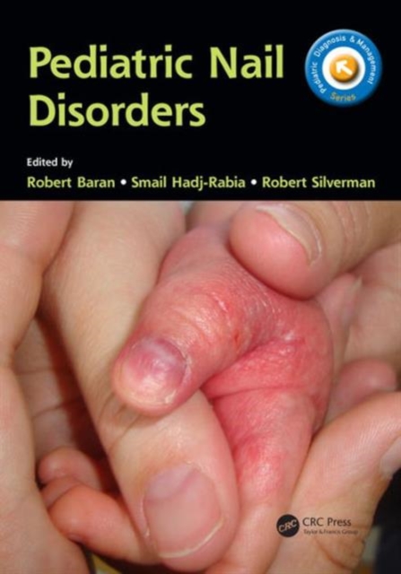Pediatric Nail Disorders, Paperback / softback Book