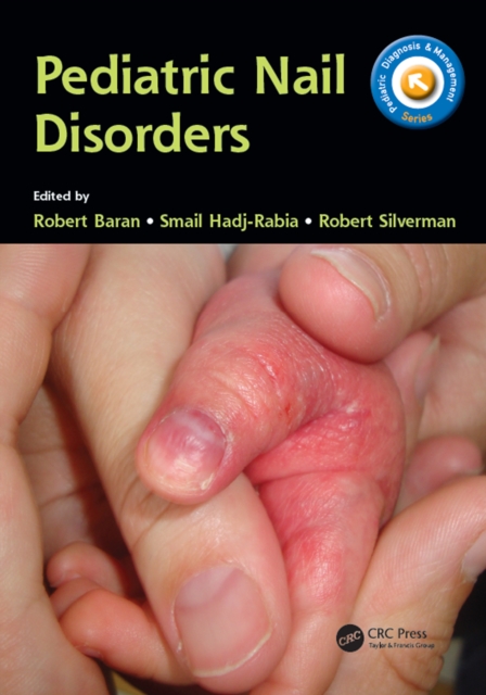 Pediatric Nail Disorders, EPUB eBook