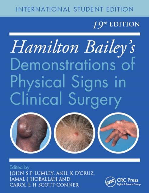 Hamilton Bailey's Physical Signs : Demonstrations of Physical Signs in Clinical Surgery, 19th Edition, PDF eBook