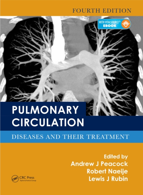 Pulmonary Circulation : Diseases and Their Treatment, Fourth Edition, EPUB eBook