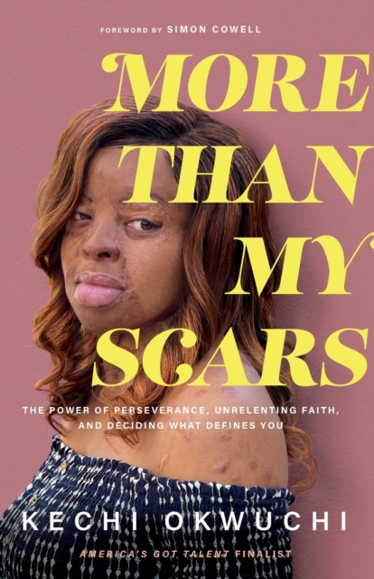 More Than My Scars - The Power of Perseverance, Unrelenting Faith, and Deciding What Defines You, Paperback / softback Book
