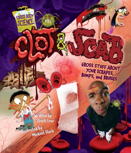 Clot & Scab : Gross Stuff about Your Scrapes, Bumps, and Bruises, EPUB eBook