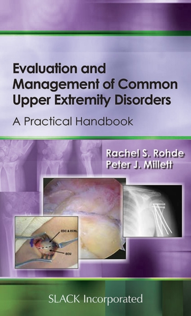 Evaluation and Management of Common Upper Extremity Disorders : A Practical Handbook, Paperback / softback Book