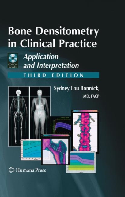 Bone Densitometry in Clinical Practice : Application and Interpretation, Multiple-component retail product Book
