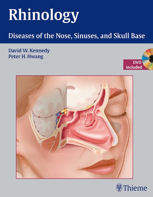 Rhinology : Diseases of the Nose, Sinuses, and Skull Base, Hardback Book