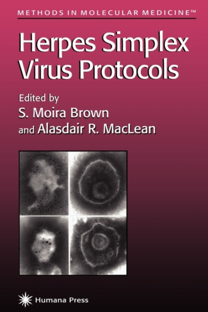 Herpes Simplex Virus Protocols, Paperback / softback Book