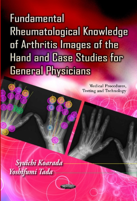 Fundamental Rheumatological Knowledge of Arthritis Images of the Hand & Case Studies for General Physicians, Paperback / softback Book