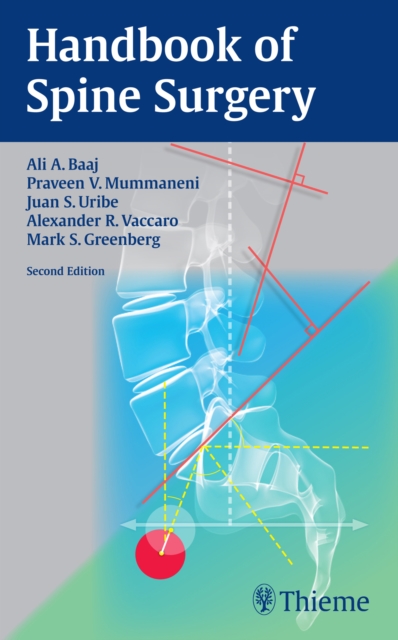 Handbook of Spine Surgery, Paperback / softback Book
