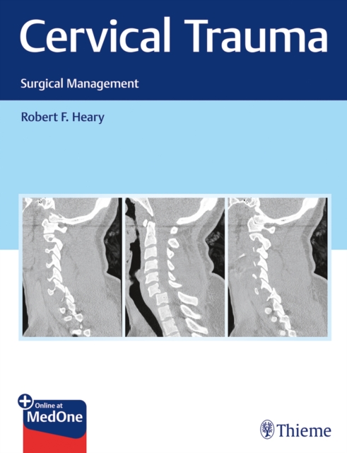 Cervical Trauma : Surgical Management, Mixed media product Book