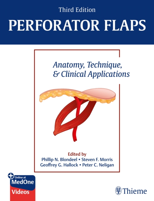 Perforator Flaps : Anatomy, Technique, & Clinical Applications, EPUB eBook