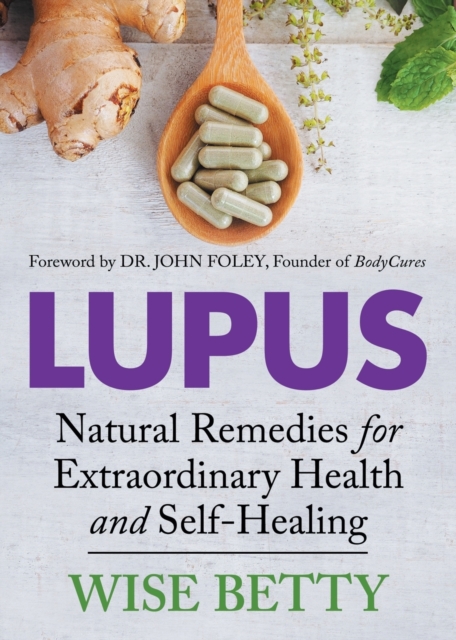 Lupus : Natural Remedies for Extraordinary Health and Self-Healing, Paperback / softback Book