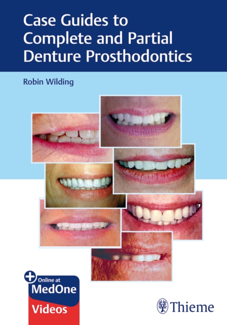 Case Guides to Complete and Partial Denture Prosthodontics, Mixed media product Book