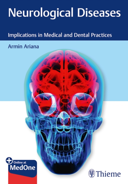 Neurological Diseases : Implications in Medical and Dental Practices, Mixed media product Book