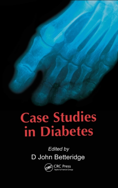 Case Studies in Diabetes, Hardback Book