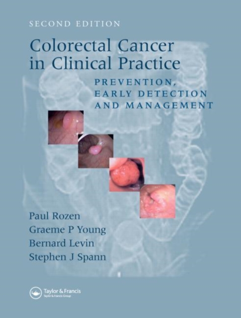 Colorectal Cancer in Clinical Practice : Prevention, Early Detection and Management, Second Edition, Paperback / softback Book