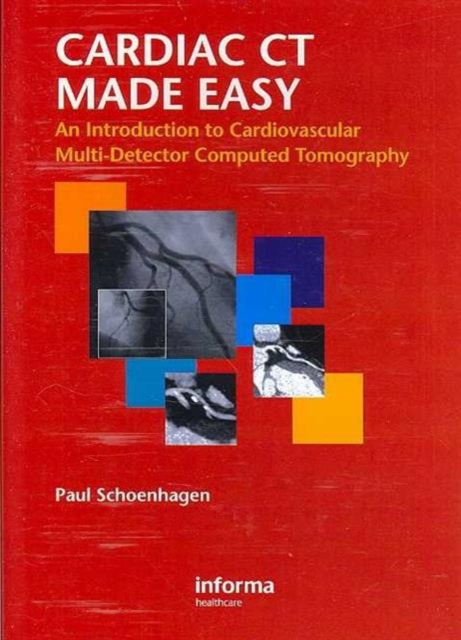 Cardiac CT Made Easy : An Introduction to Cardiovascular Multidetector Computed Tomography, DVD-ROM Book