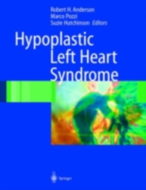 Hypoplastic Left Heart Syndrome, PDF eBook
