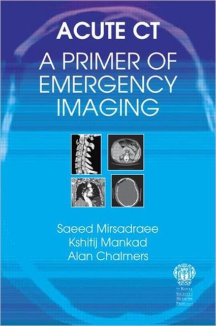 Acute CT: A Primer of Emergency Imaging, Paperback / softback Book
