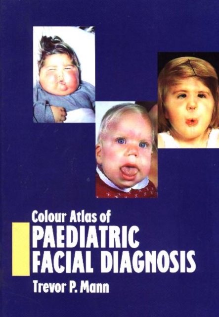 Colour Atlas of Paediatric Facial Diagnosis, Hardback Book