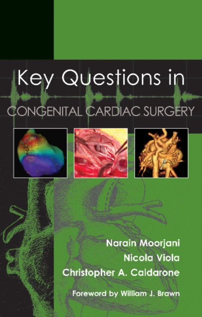Key Questions in Congenital Cardiac Surgery, Paperback / softback Book
