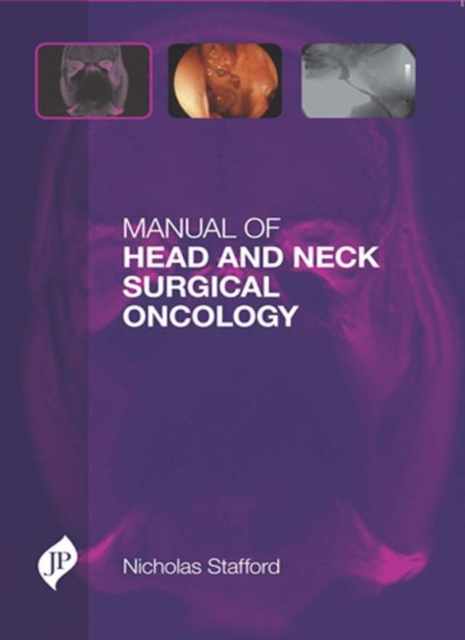 Manual of Head and Neck Surgical Oncology, Hardback Book