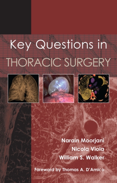 Key Questions in Thoracic Surgery, EPUB eBook