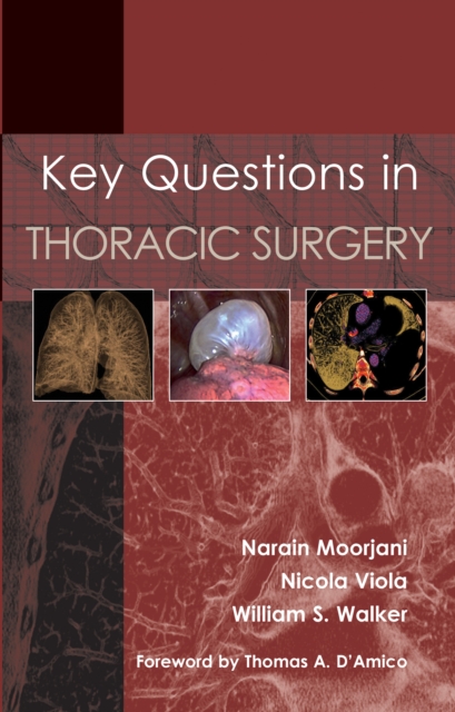Key Questions in Thoracic Surgery, PDF eBook
