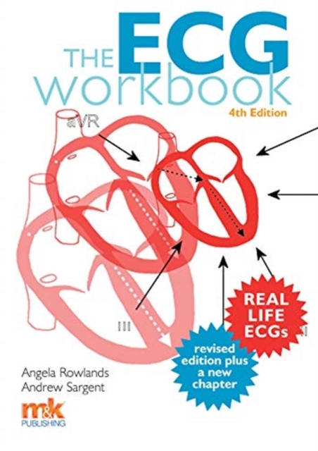 The ECG Workbook, Paperback / softback Book