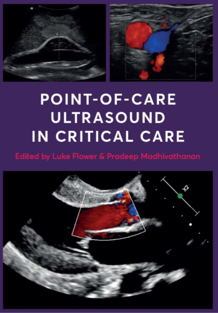 Point-of-Care Ultrasound in Critical Care, Paperback / softback Book