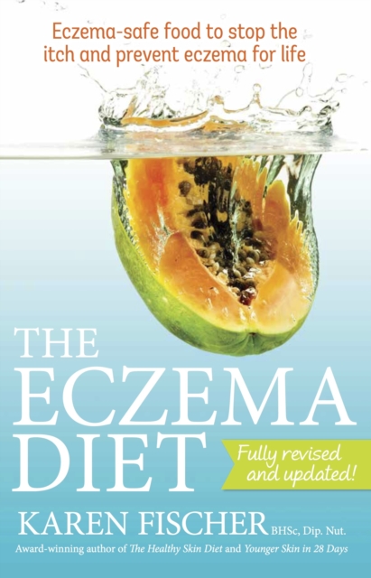 The Eczema Diet : Eczema-safe food to stop the itch and prevent eczema for life, Paperback / softback Book