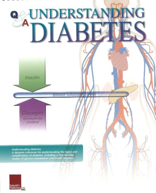 Understanding Diabetes Flip Chart, Spiral bound Book