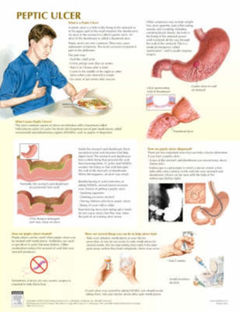 Peptic Ulcer Chart, Poster Book