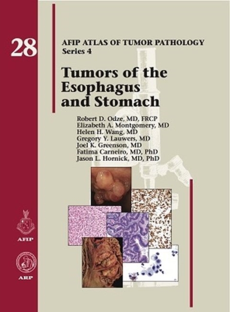 Tumors of the Esophagus and Stomach, Hardback Book