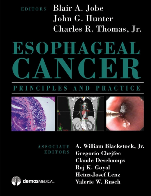 Esophageal Cancer : Principles and Practice, EPUB eBook