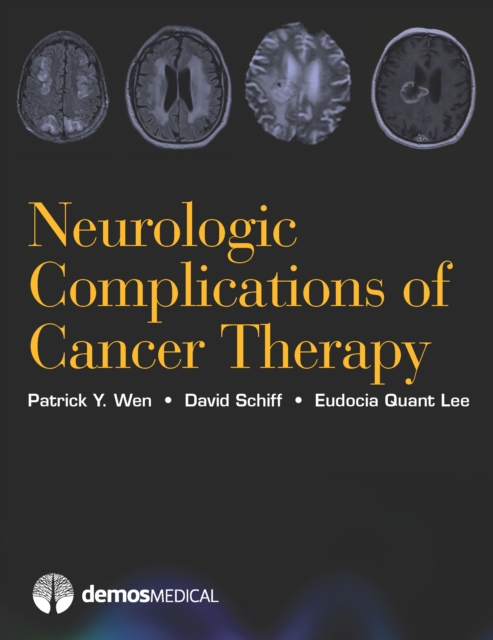 Neurologic Complications of Cancer Therapy, Hardback Book